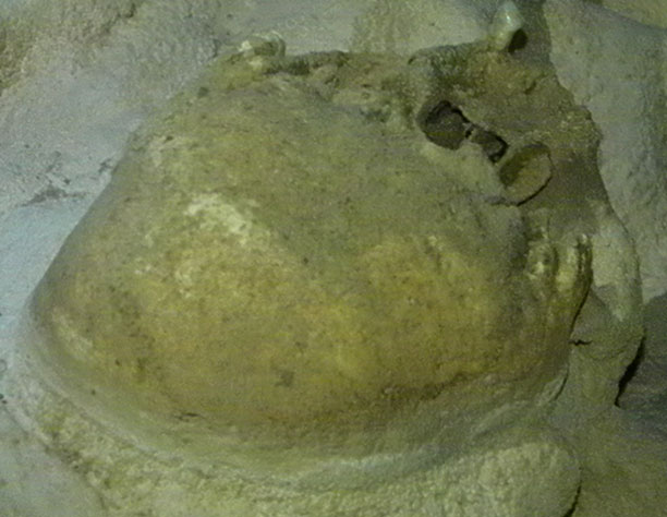 Skull